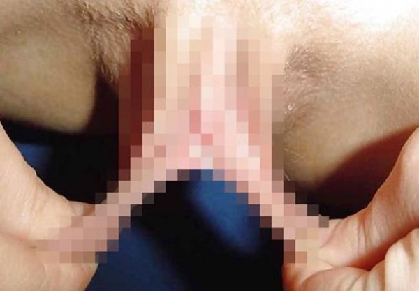 【小陰唇エロ画像】これぞヤリマンの証！？小陰唇伸びすぎだろｗｗｗ肥大化したビラビラをご覧くださいｗｗｗ その【小陰唇エロ画像】これぞヤリマンの証！？小陰唇伸びすぎだろｗｗｗ肥大化したビラビラをご覧くださいｗｗｗ その10