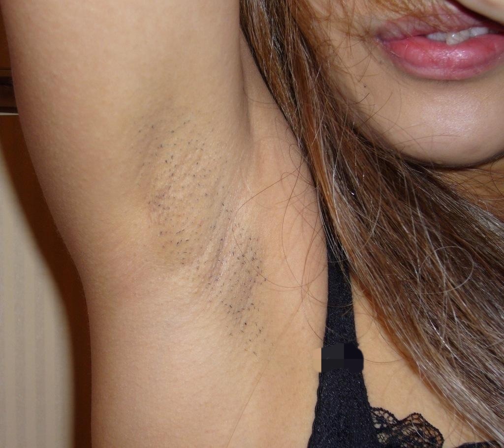 【腋フェチエロ画像】剃り残したジョリジョリの腋…女の子の恥ずかしすぎる恥部がたまらねーｗｗｗｗ その13